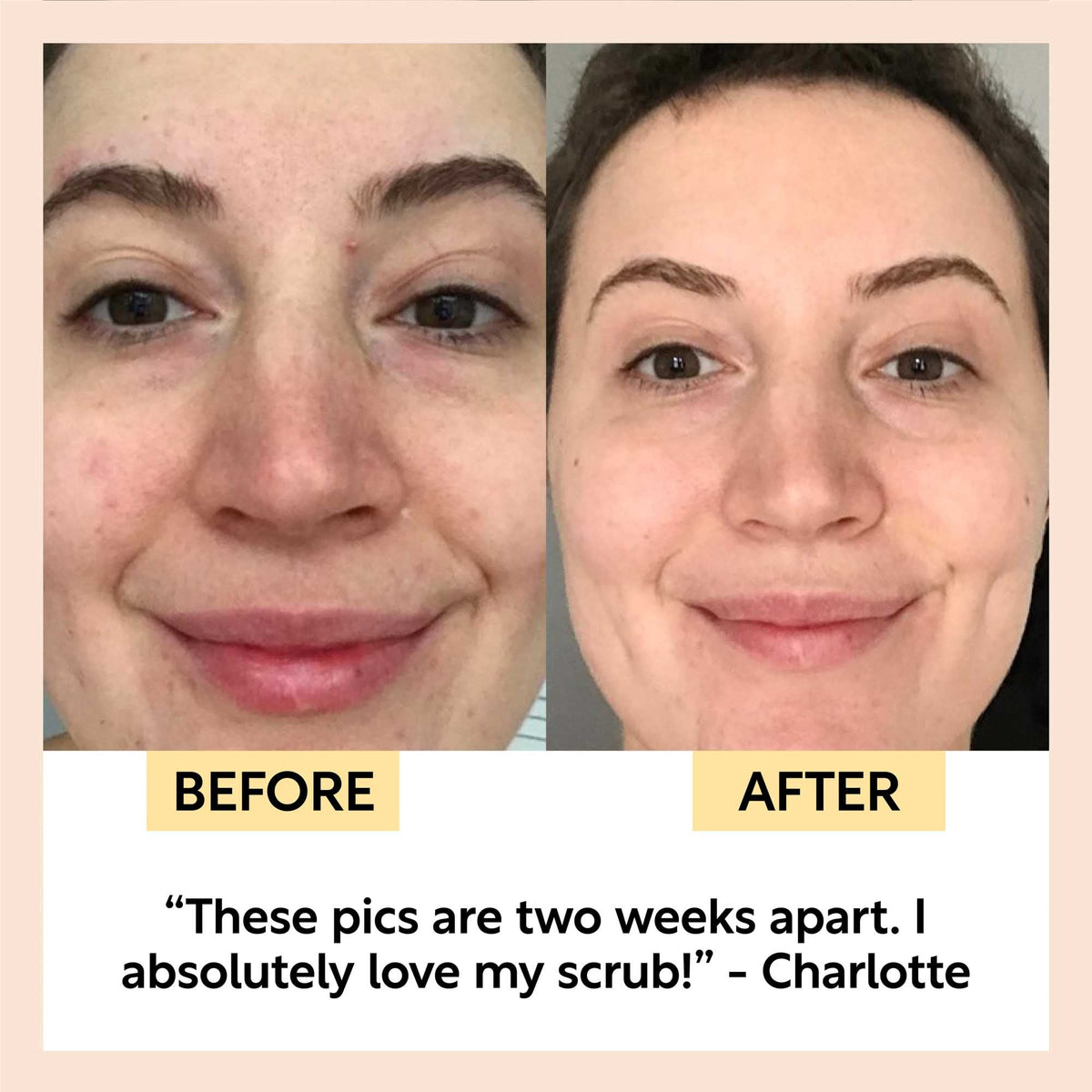 UpCircle Travel-Size Skincare Bundle with Cotton Wash Bag